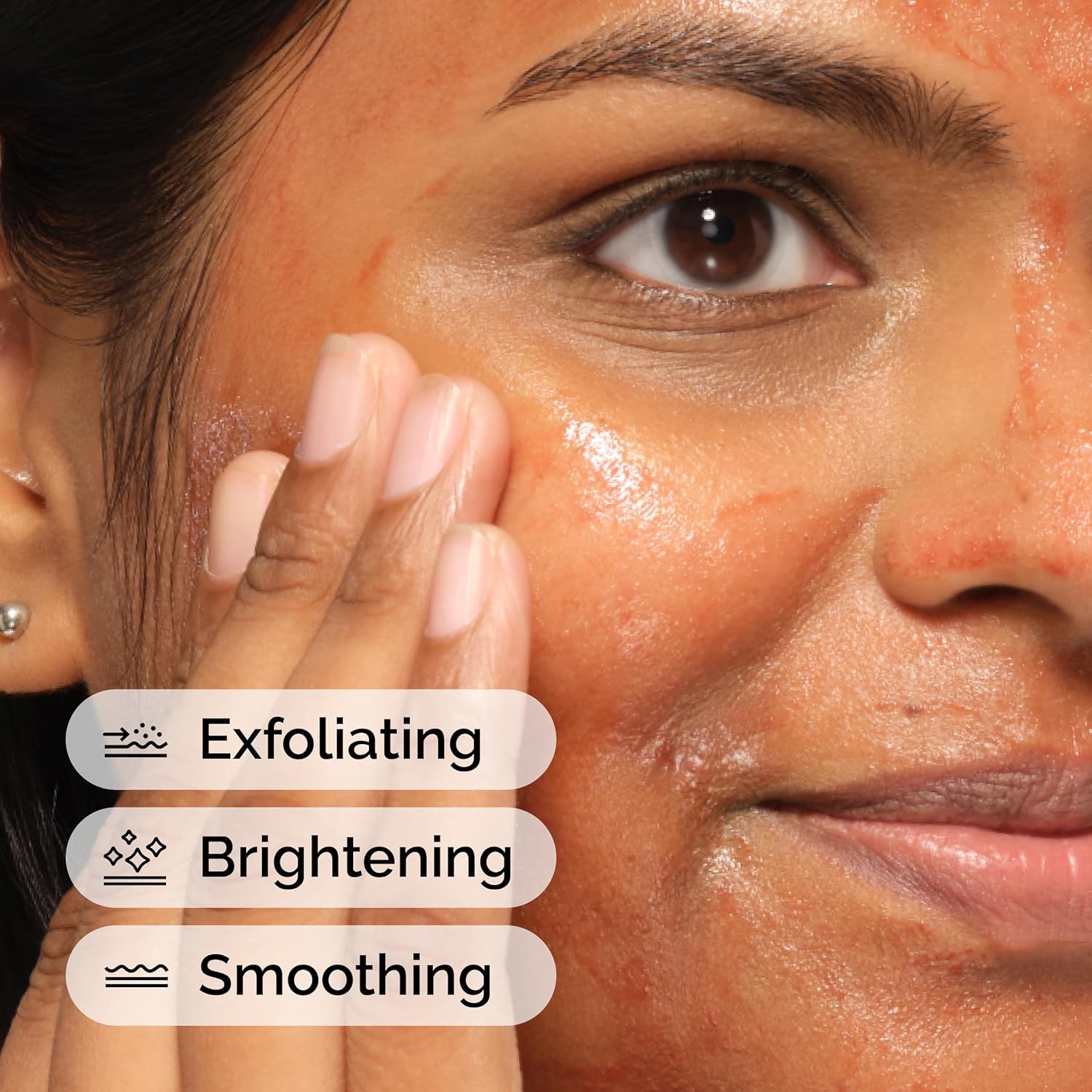 The Ordinary AHA 30% + BHA 2% Peeling Solution, Advanced Exfoliating Peel for Brighter Skin, 30ml ,Imported, Canada - Image 5